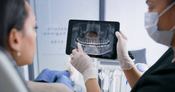 Licensed Wisdom Tooth Removal service in Macon County County, NC - Smile Center Dentistry